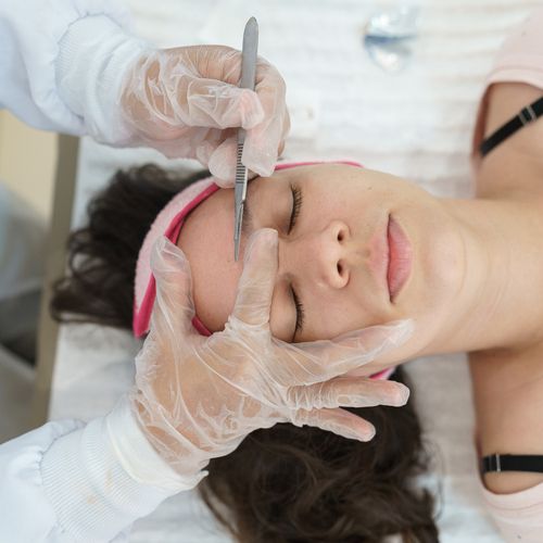 Female patient receiving facial dermaplaning microdermabrasion  from provider with clean gloves