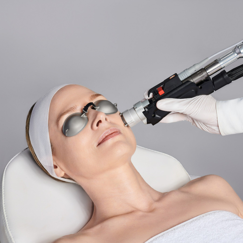Medical Aesthetics patient receiving facial skin rejuventation via laser