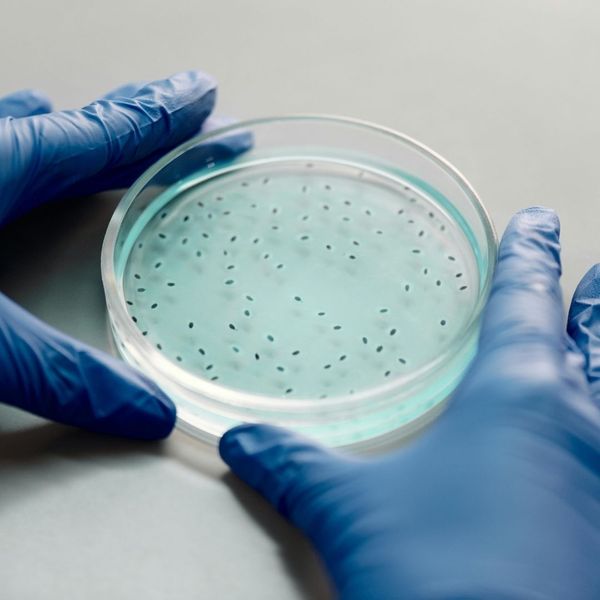 biological tray with bacteria samples biological tray with bacteria samples