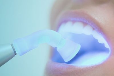 Restorative Dentistry 1.jpg