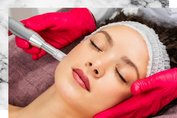 microneedling. 