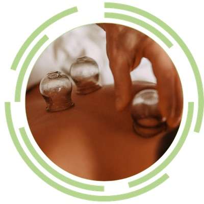 Cupping