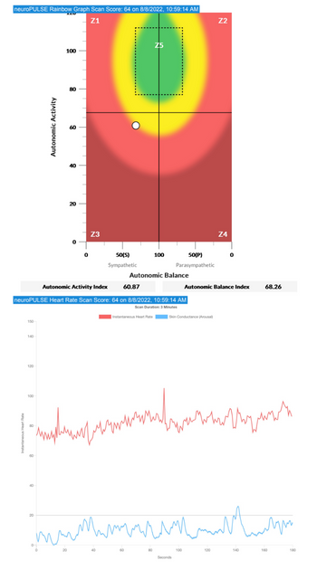 HRV.png