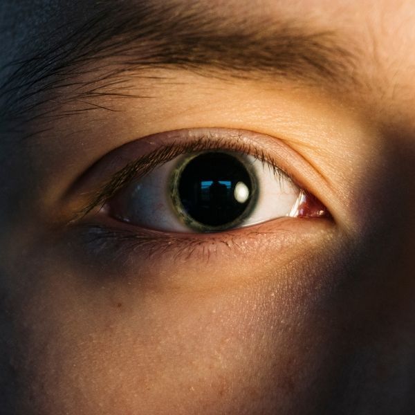 Dilated Pupil