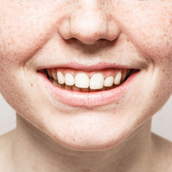 up close view of a woman smiling