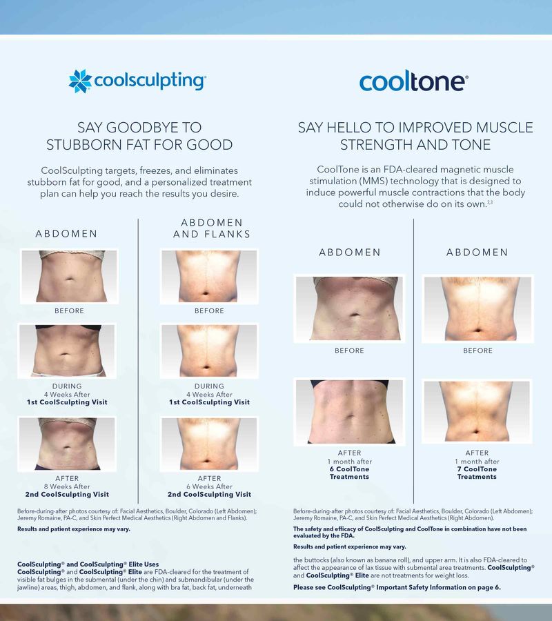 brochure before and after cooltone and coolsculpting