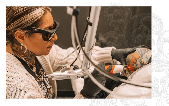 Laser Tattoo Removal PB Pic 1.png