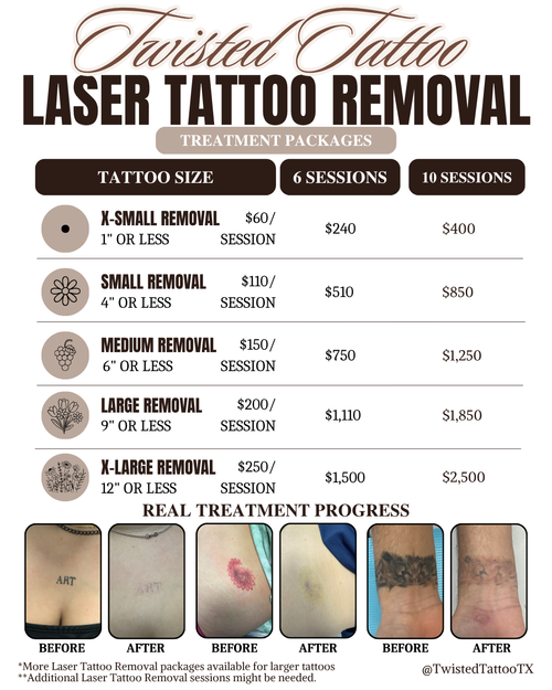 Laser Tattoo Removal Package | Twisted Tattoo San Antonio.png