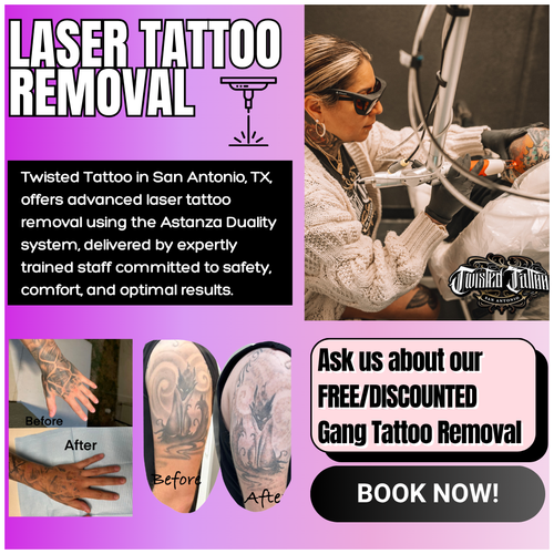 Twisted Tattoo Main Page Slides _ Laser Removal.png